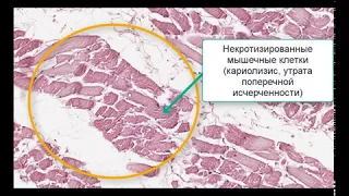 МИКРОПРЕПАРАТЫ ЧАСТЬ 1