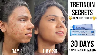 Tretinoin Secrets No one tells you about🤫🌸✨ My 30 days skin transformation using tretinoin