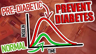 How Hidden Prediabetic Patients are found with Kraft Tests and 5 Major Causes of Insulin Resistance