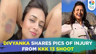 Divyanka Tripathi shares her SHOCKING injury marks while shooting for Khatron Ke Khiladi 13