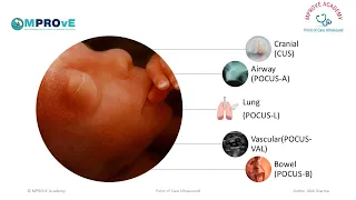 Session 22-Neonatal Lung Ultrasound and Lung Recruitment