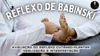 Sinal de Babinski!!! Aprenda a avaliar e interpretar o teste de sensibilidade cutâneo-plantar.