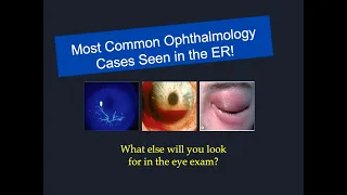 Top 10 Most Common Ophthalmology Emergencies You Will Encounter on Your Next Ophtha Rotation!