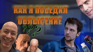 Миноксидил. Побеждаем облысение | Восстановление выпавших волос | Как правильно использовать