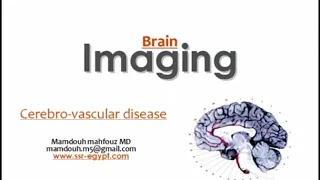 Imaging of cerebrovascular disease (DRE) Prof. Mamdouh Mahfouz