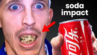 Can I drink SODA with Braces On? Orthodontist explains…