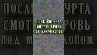 Йогурт  кровь под микроскопом