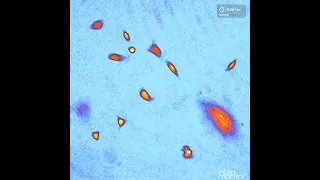 Image & analyze cancer cell behavior over time | HoloMonitor®