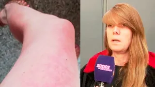 Nueva doctora denunciada por usar los mismos productos que Aníbal Lotocki: La historia de la víctima