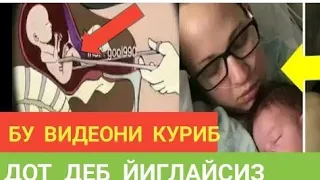 ТУҒИЛМАГАН ЧАҚАЛОҚ НОЛАСИ😪😪😪