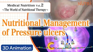 Medical Nutrition ~The World of Nutritional Therapy~ Vol.2 Nutritional Management of Pressure ulcers