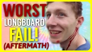 WORST LONGBOARDING CRASH! (Full Footage)