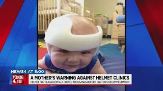 Baby helmet issues