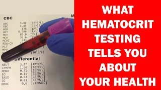 What Hematocrit Tells You About Your Health (Hematology)