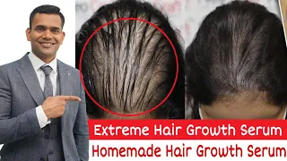 DIY Extreme Hair Growth Serum | Powerful Homemade Serum For extreme Hair Growth