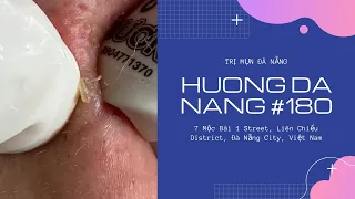 #180 | Huong Da Nang