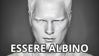 Essere Albino cosa significa