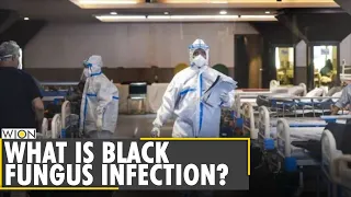 Black Fungus on rise in India | COVID-19 infection | What is black fungus | Latest English News