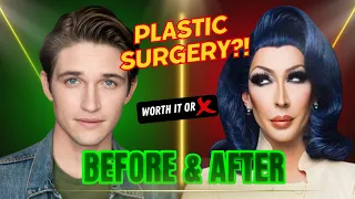 Celebs Who Went TOO FAR with Plastic Surgery
