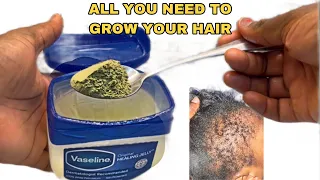 No joke!This hair growth recipe with VASELINE will be ya last stop! 10X ya hair growth!April 5, 2024