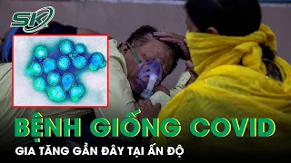 Xuất Hiện Bệnh Truyền Nhiễm Có Triệu Chứng Tương Tự COVID-19 Gia Tăng Gần Đây Tại Ấn Độ I SKĐS