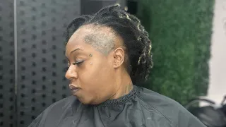 She thought her hairstyle would restore her hairline.