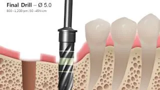 2D Manual SuperLine Drilling sequence guide