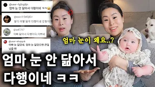 "엄마 눈 안 닮아서 다행이네ㅋㅋ" 5번의 전신마취.. 수술로 생긴 눈 상처 최초 공개 | 내가 평생 눈을 못 감는 이유는?