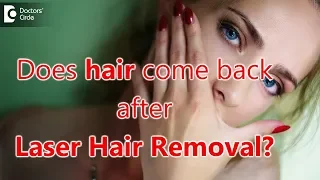 Does hair grow back after laser hair removal? - Dr. Nischal K