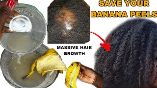 Do not throw away banana peels! do this instead for unstoppable hair growth.