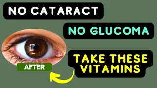 9 Vitamins to Prevent CATARACT and GLUCOMA