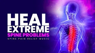 Set Up Your Spinal Cord | Heal Extreme Spine Problems | Spine Pain Relief Music | Isochronic Tones