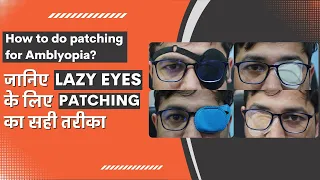 AMBLYOPIA KA TREATMENT || PATCHING THERAPY || AMBLYOPIA KI EXERCISE