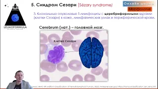 🩸ЗРЕЛЫЕ Т- и NK-КЛЕТОЧНЫЕ ЛЕЙКОЗЫ по новой 5-ой классификации ВОЗ, 2022 года. Трейлер занятия №3.