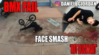 BMX FACE SMASH|FAIL BMX | ЖЕСТЬ |FACE CRASH ON BMX | ПАДЕНИЕ НА БМХ | ЛИЦОМ ОБ БЕТОН|ШОК КОНТЕНТ