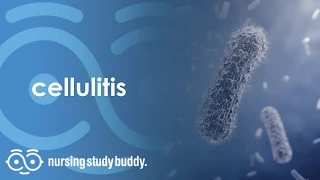 Cellulitis - Nursing Study Buddy Video Library