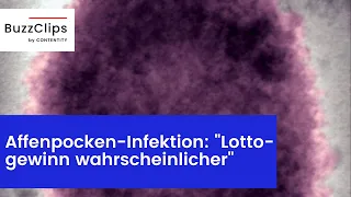 Affenpocken-Infektion: "Wahrscheinlicher im Lotto zu gewinnen"