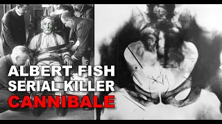 Albert Fish: il Serial-Killer cannibale che terrorizzò Brooklyn