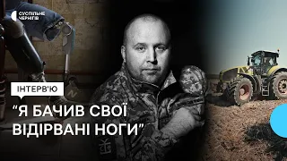 Сісти й забухати – це найлегше┃Ветеран Вадим Медвідь про втрату ніг, оптимізм та чорний гумор