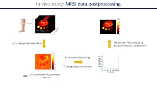 Sodium Imaging and T* Mapping Using FID Magnetic Resonance Spectroscopic Imaging at 3T