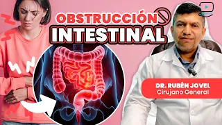 😮¿Qué causa la obstrucción intestinal? Descubre los peligros | Doctor Jovel - Cirujano General