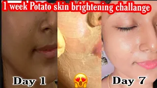 😍🔥All in all Remedy/potato one week challange/ skin brightening/ No dark circles,spots, pigmentation