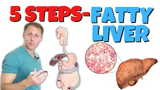 5 Steps to Improve Fatty Liver Issues