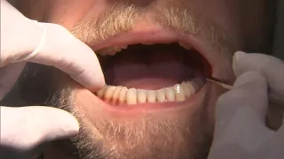 How to prevent yourself from grinding your teeth