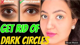 7 DAYS CHALLENGE : DIY SERUM To Remove DARK CIRCLES PERMANENTLY in 1 WEEK |  Preity प्रेरणा