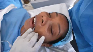 Girl Undergoing General Anesthesia 💉 for jaw surgery