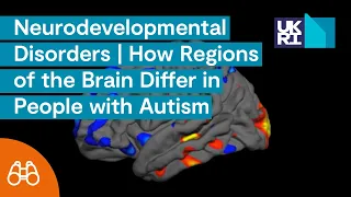 Neurodevelopmental Disorders | How Regions of the Brain Differ in People with Autism
