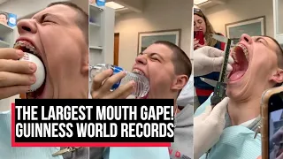 The Guinness World Record For The Widest Gaping Mouth | The largest mouth gape! | Cobrapost