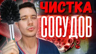 Атеросклероз артерий! Бляшки в сосудах! Чистка артерий!