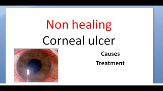 Ophthalmology 114 a Non healing corneal ulcer Cornea Causes Treatment